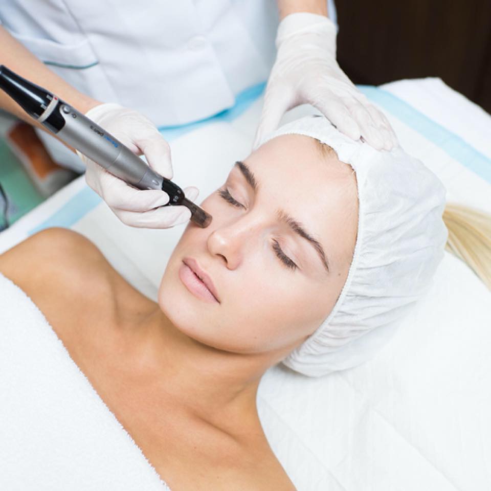 Microneedling